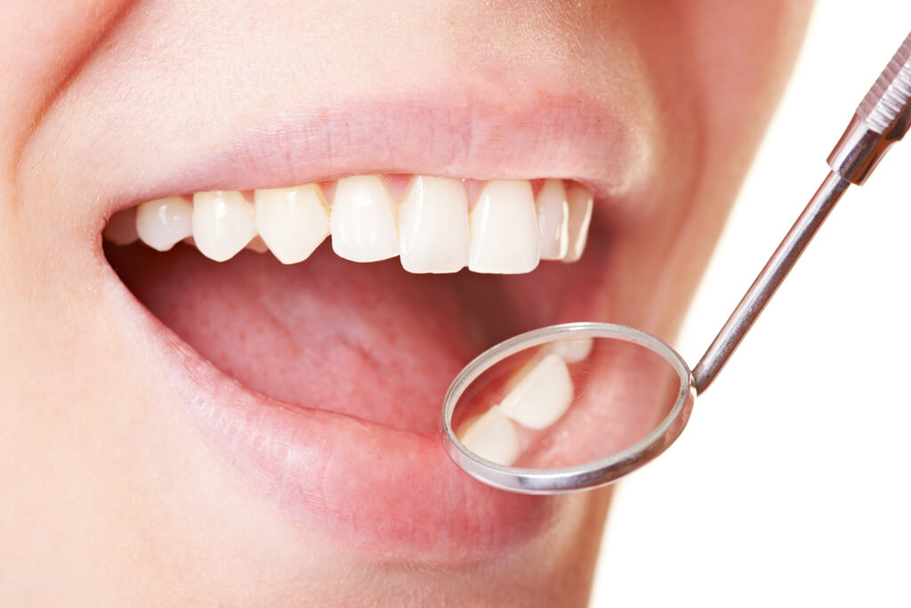 定期検診とセルフケアの指導