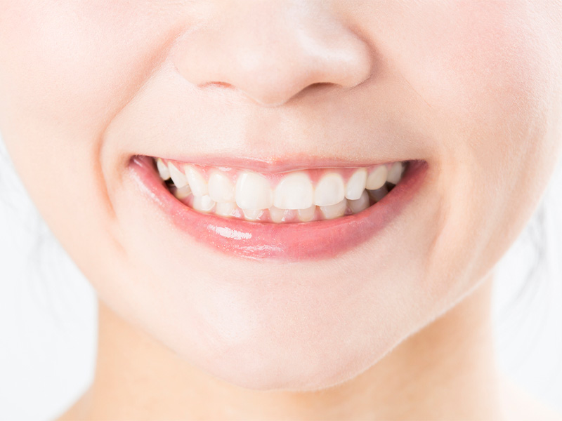 前歯の隙間などの歯並びを短期間で改善